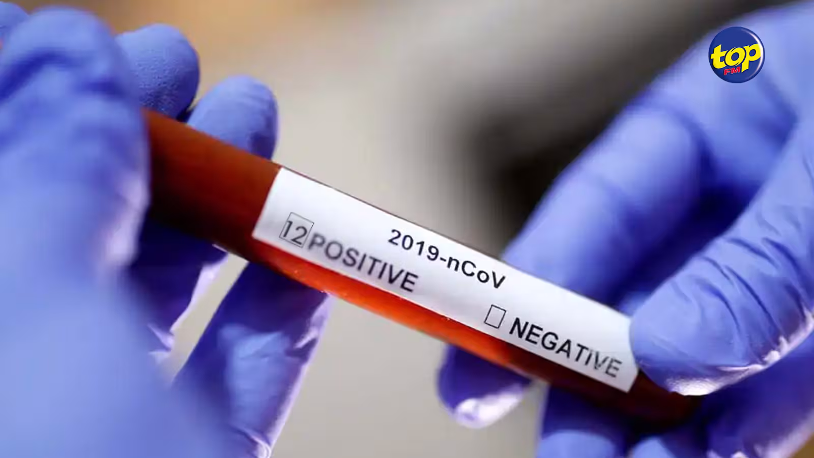 COVID-19 : 12  nouveaux  enregistrés au 7e jour dans des facilités sanitaires