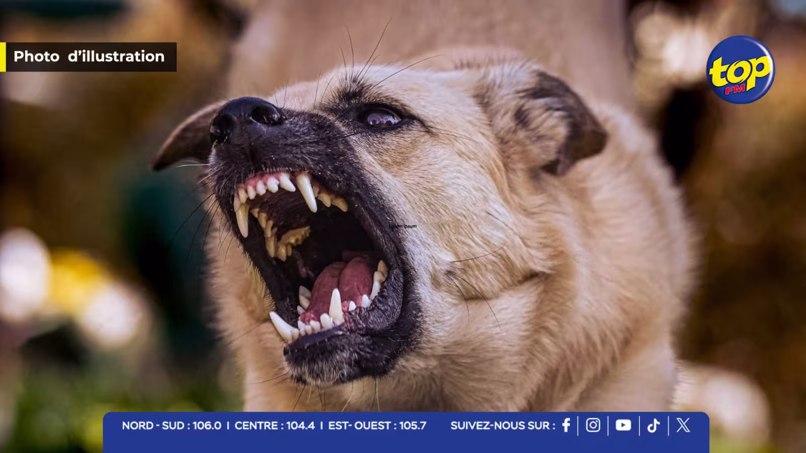 Drame à Tahiti : un enfant de 2 ans tué, des morsures de chien fortement suspectées