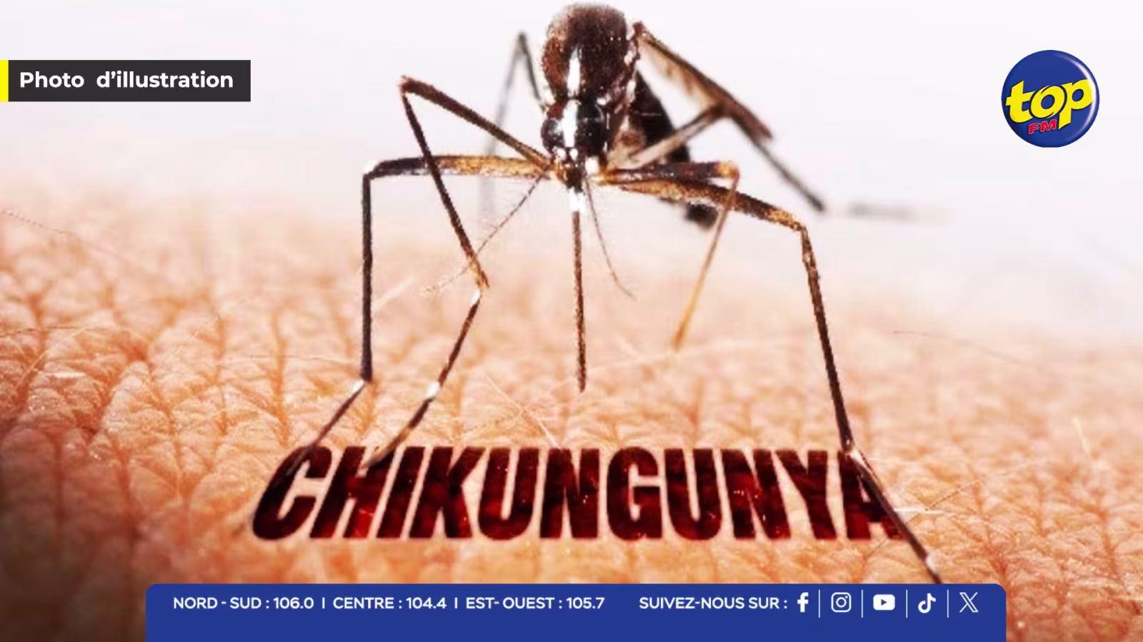 Un premier cas de chikungunya détecté à Roche-Brune : une femme d’une soixantaine d’années touchée, selon le Dr Fazil Khodabaccus