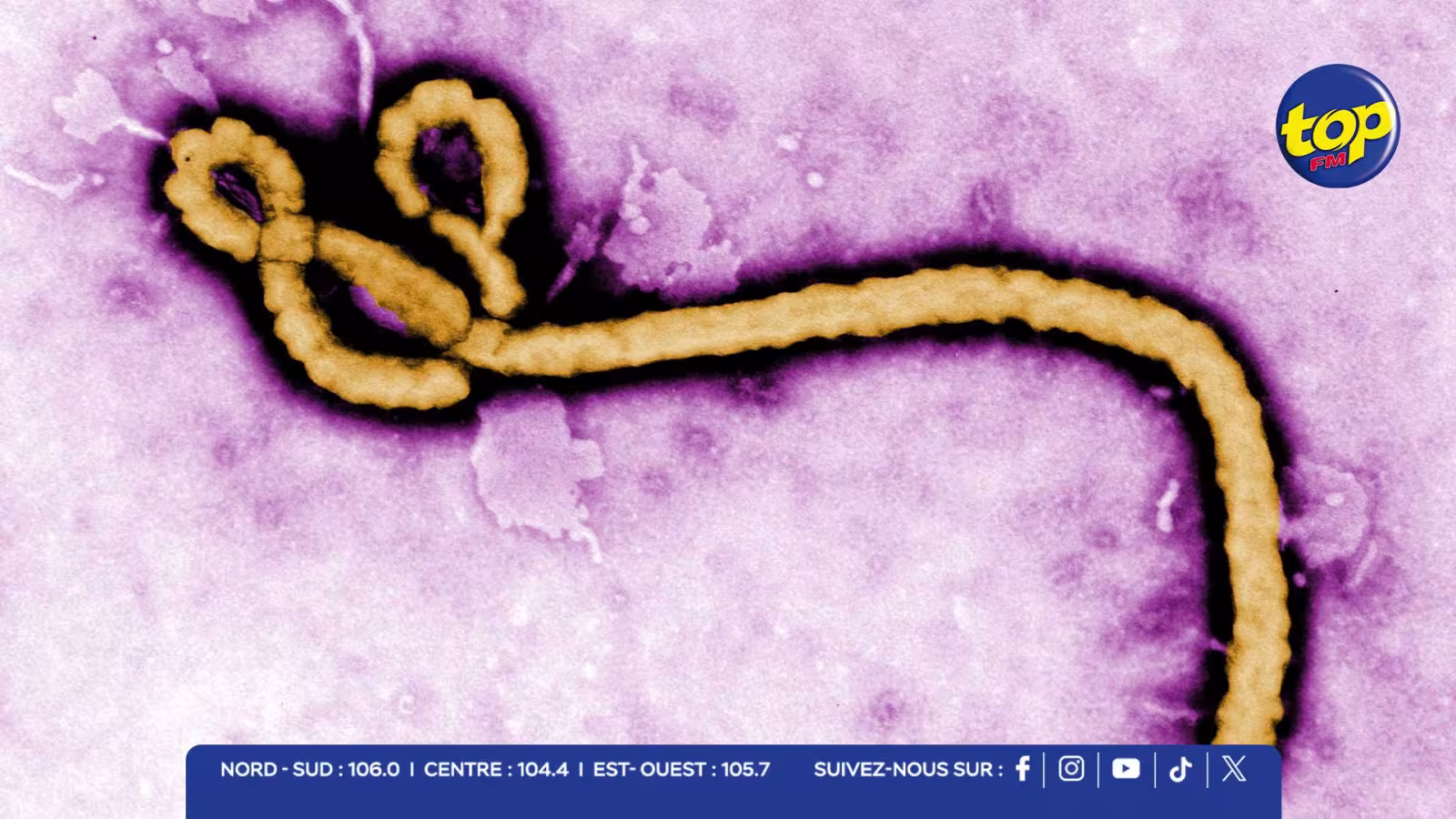 Ebola : le ministère de la Santé renforce les mesures de prévention