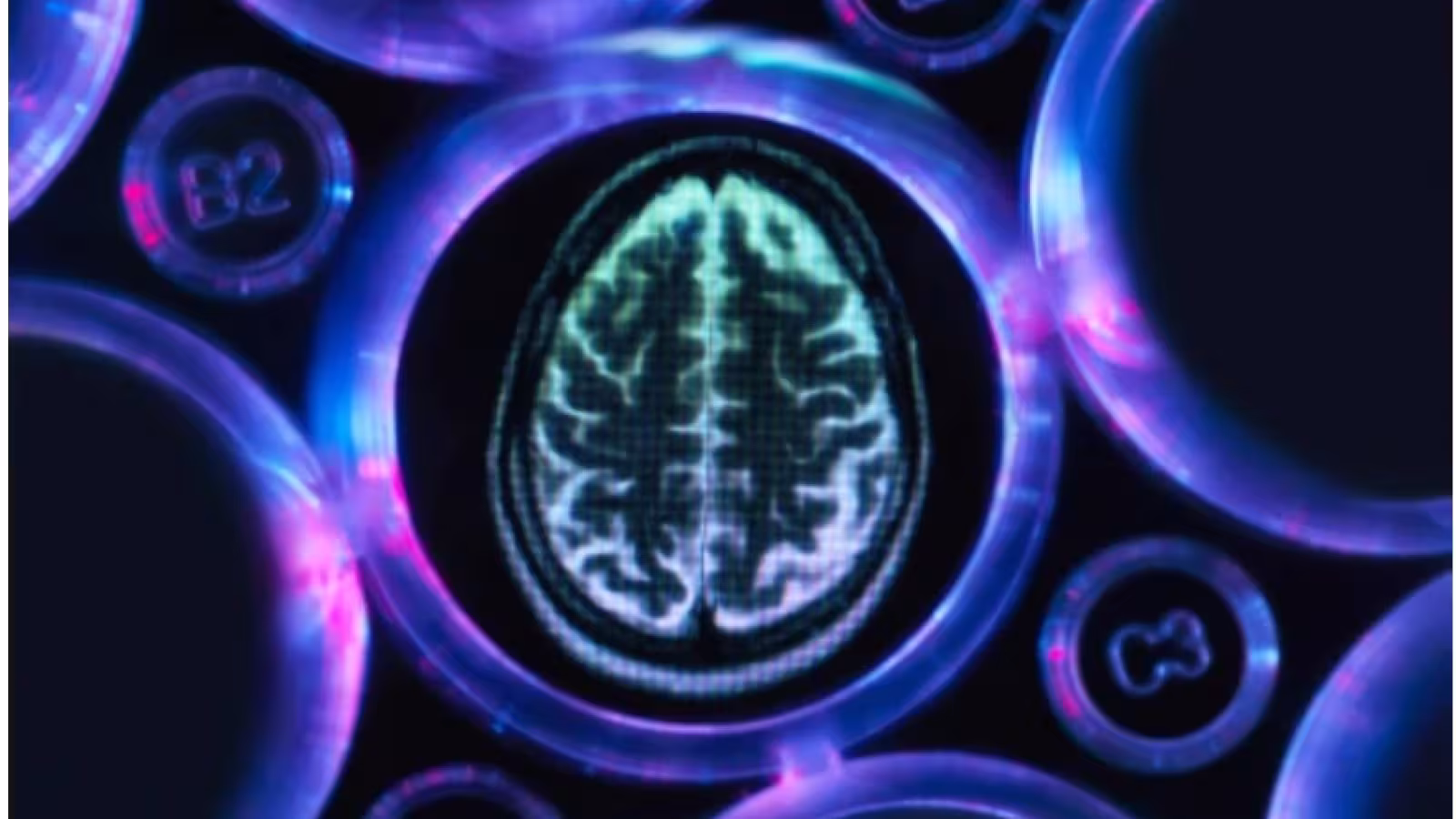 Un nouveau test peut “diagnostiquer la maladie d’Alzheimer des années avant qu’elle ne se développe”