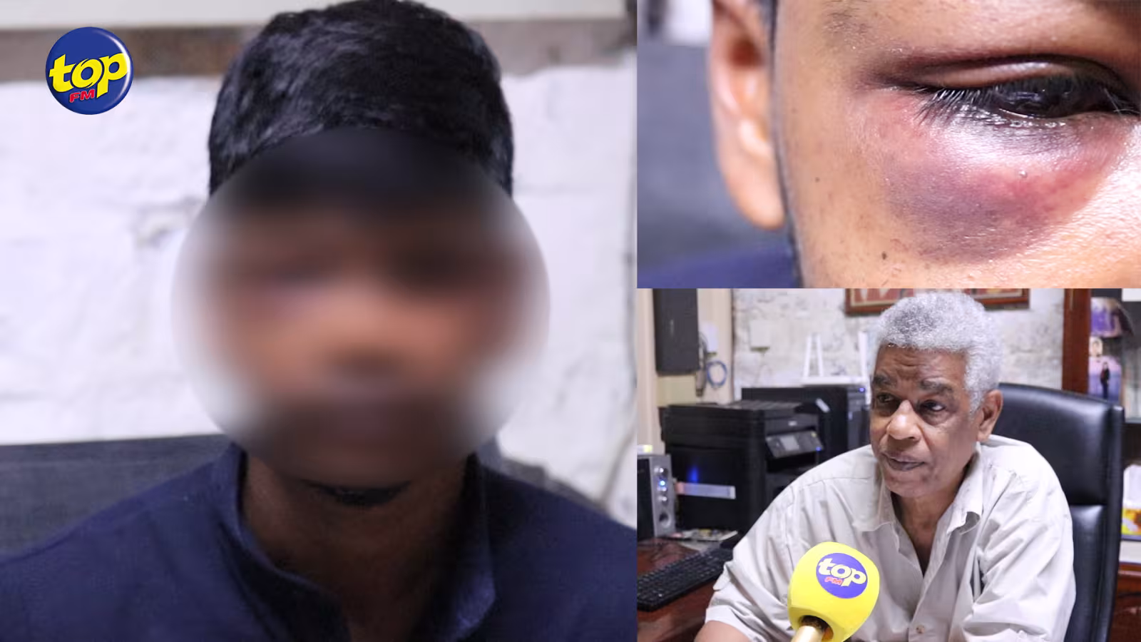Brutalité policière alléguée : un jeune homme de 21 ans battu et forcé à boire du liquide lave-vaisselle et du savon par des policiers