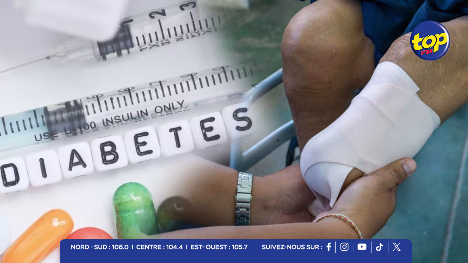 DIABETES