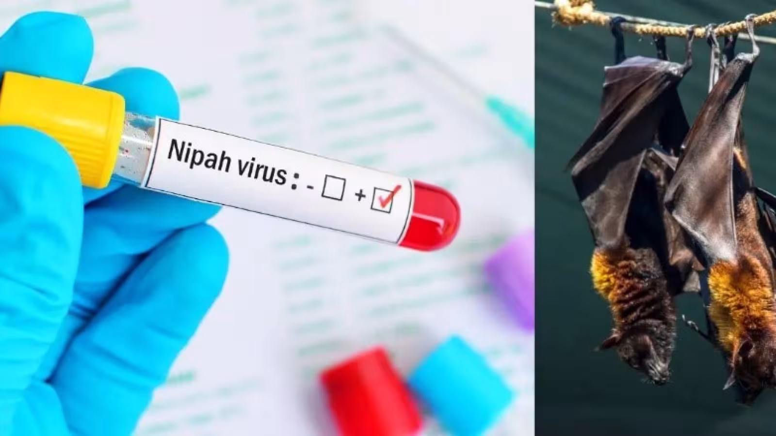 Qu’est-ce que Nipah, le virus à l’origine d’une épidémie que l’Inde essaye de contenir ?