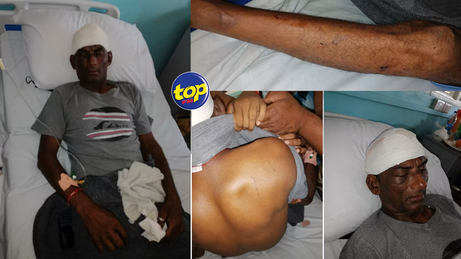 Satyanand Bulloram agressé à coups de sabre par son neveu à l’Escalier : « son état de santé est toujours critique » affirme son frère Mohit Bulloram