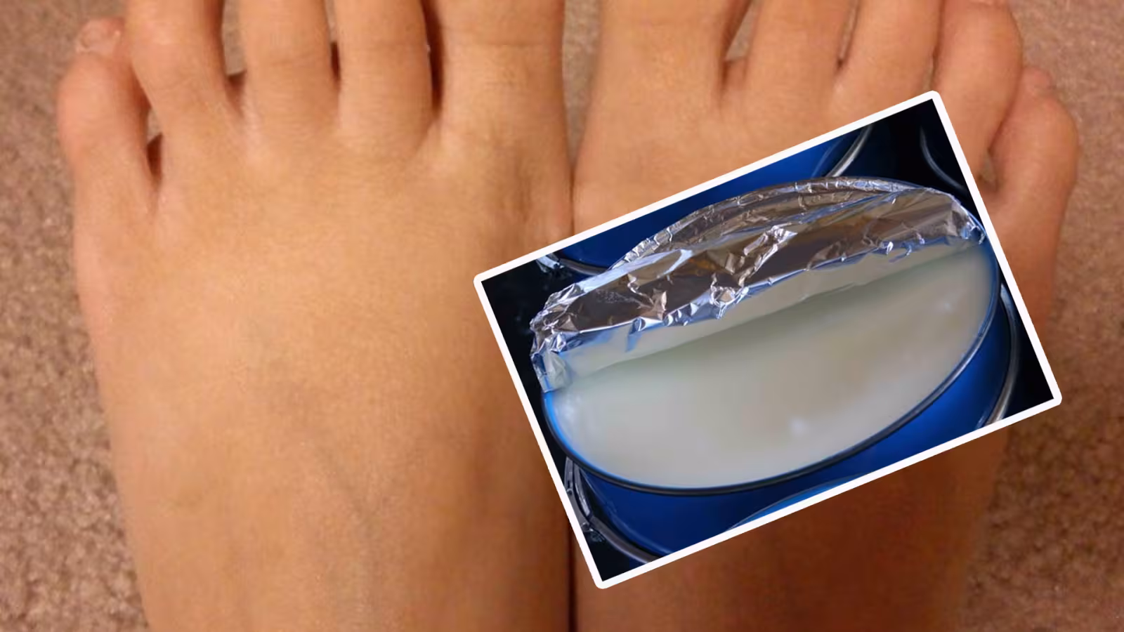 La vaseline pour éviter les ampoules
