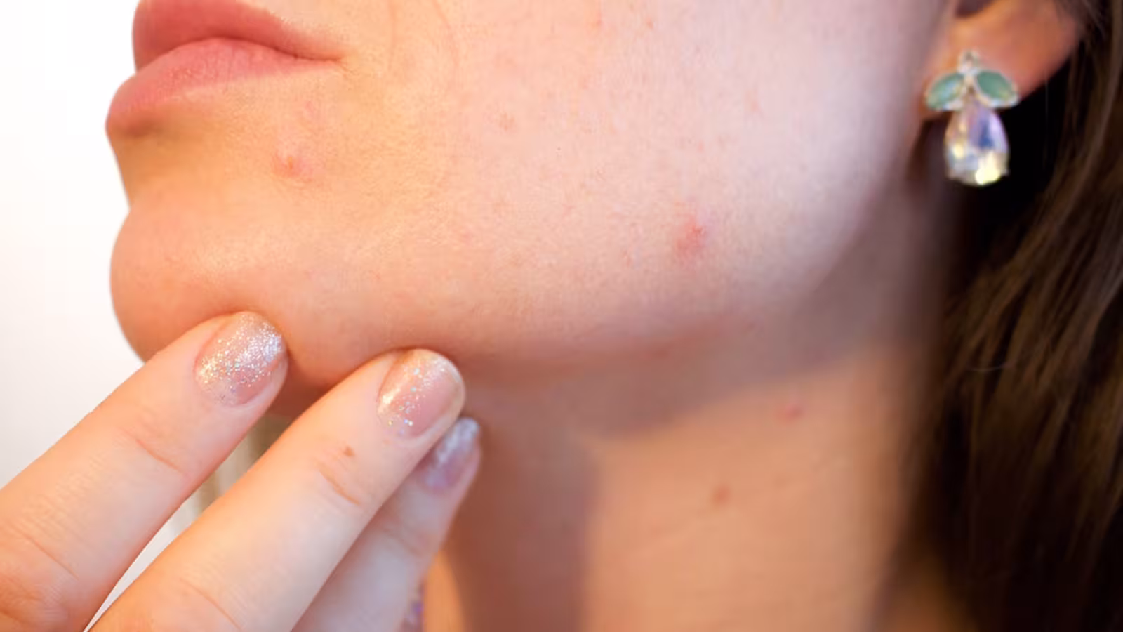 Comment faire disparaître un bouton naturellement