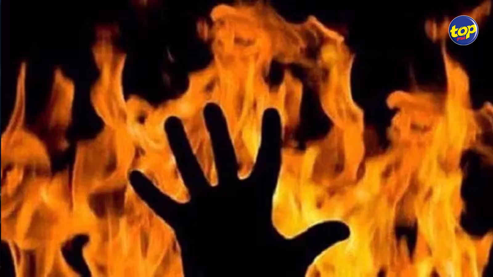 À Rivière du Rempart : Une femme succombe à ses brûlures