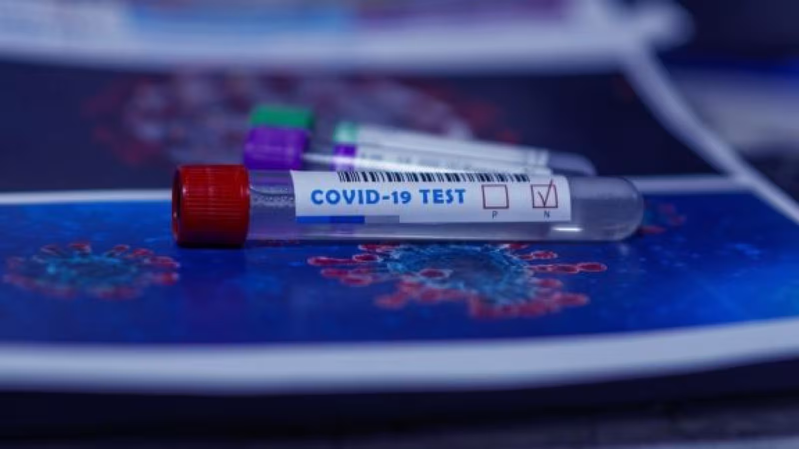 Coronavirus : un  dépistage rapide en masse tuera la pandémie en quelques semaines selon Harvard