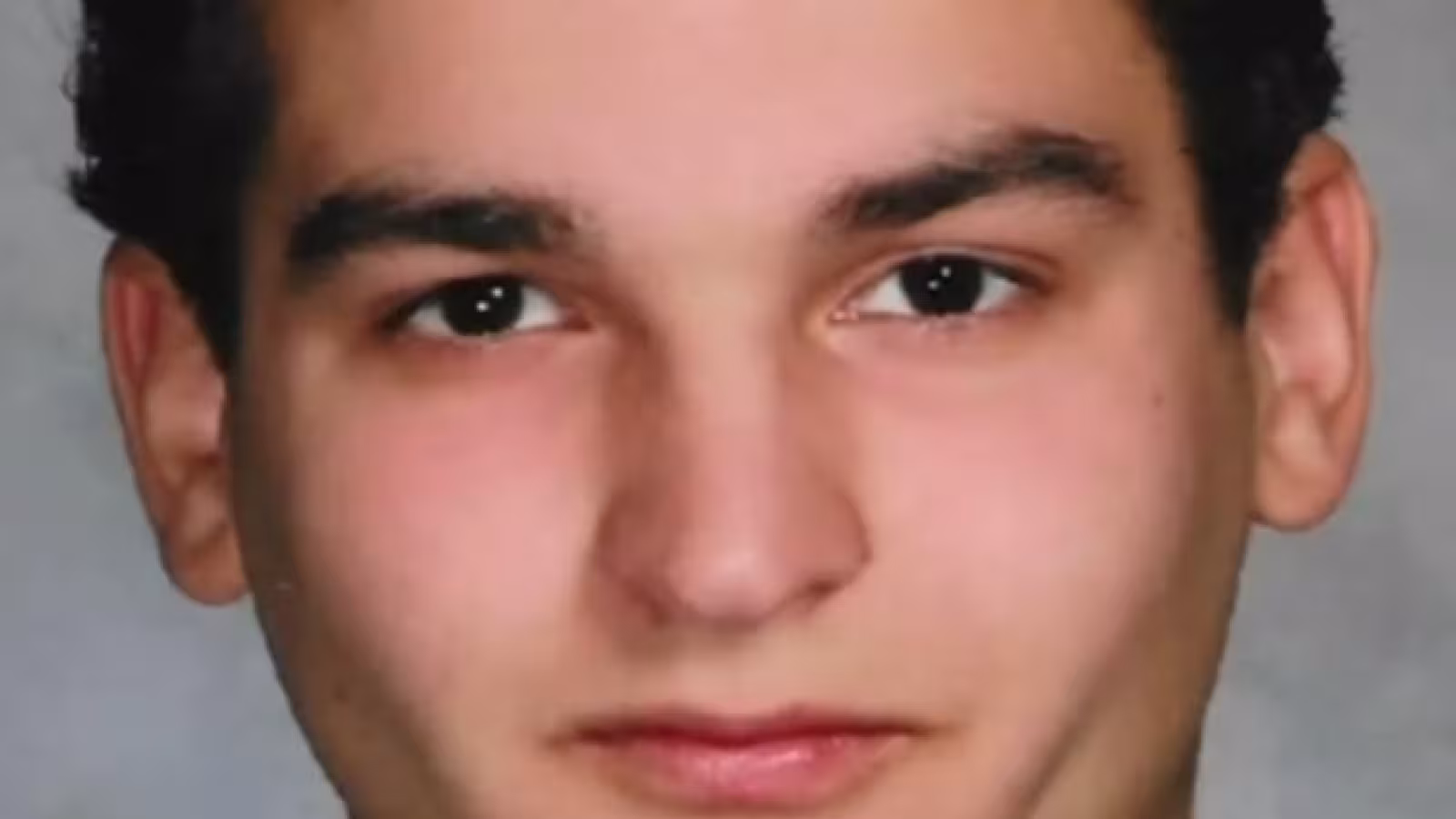 Triple greffe réussie du visage et des deux mains pour Joe DiMeo