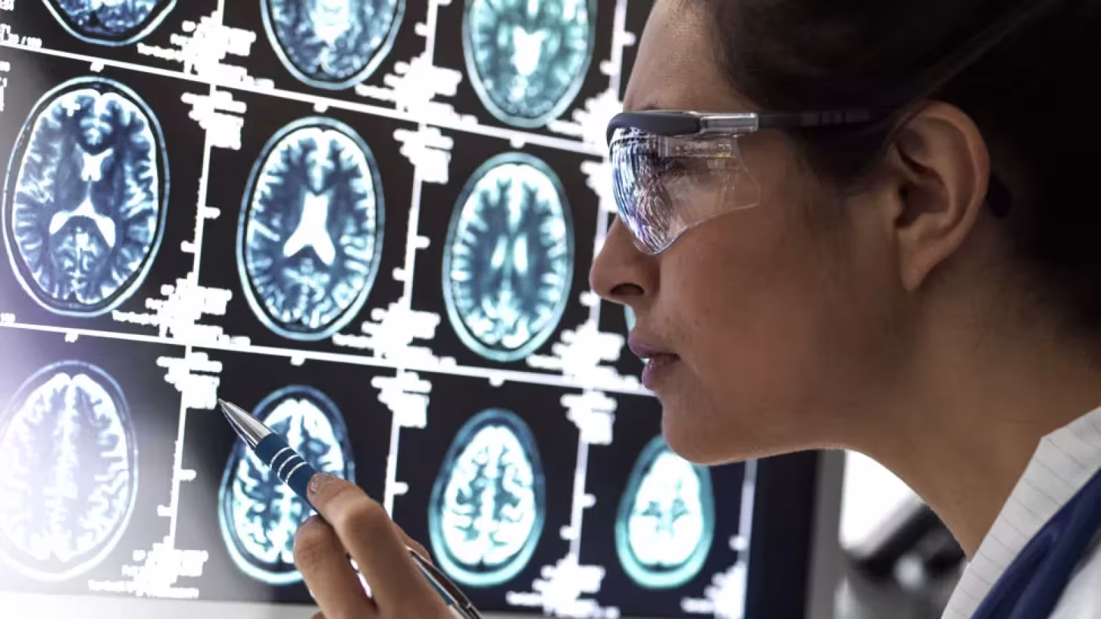 Le donanemab est considéré comme un tournant dans la lutte contre la démence