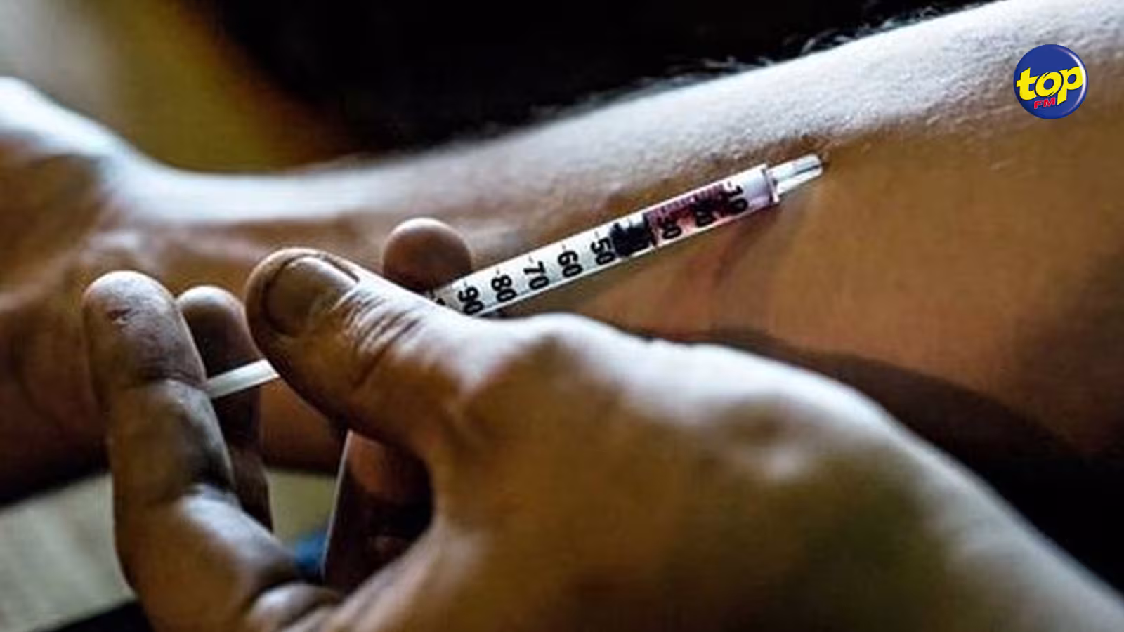 La prévalence de la syphilis a augmenté de 80% chez les utilisateurs de drogues intraveineuses en 9 ans