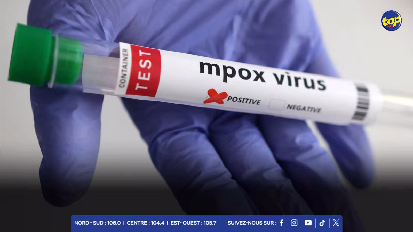 Le Conseil des ministres a pris acte d’un cas suspect de Mpox signalé le 25 octobre 2024.