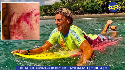 États-Unis : un surfeur de Floride survit à une attaque de requin