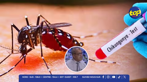 Chikungunya