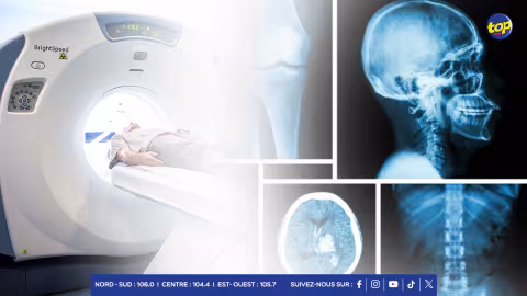 Journée internationale de la radiologie : célébrer une révolution scientifique qui sauve des vies