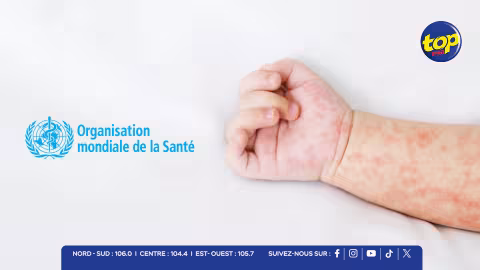 L’OMS considère que l’élimination de la rougeole et de la rubéole à Maurice est une étape majeure en matière de santé publique.