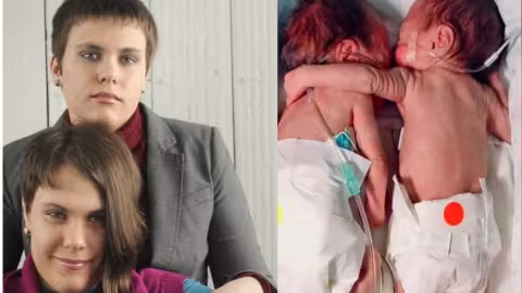 Le mystère des jumeaux : Elle n’avait que trois semaines quand elle a sauvé la vie de sa sœur