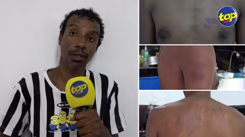 Allégation de séquestration à Terre Rouge : Laurent Oraison, un habitant de Cité la Cure, ‘j’ai été forcé à monter dans le van sans vêtements, j’ai été agressé avec une barre de fer et à l’aide d’un taser’, raconte-t-il