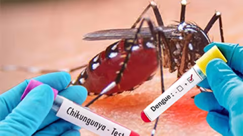 Santé : Cinq cas de chikungunya recensés en une semaine  