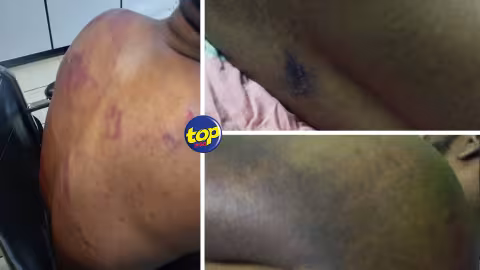 Brutalité policière alléguée : La police intervenait lors d’une agression commis par un habitant de Plaine-Verte sur sa femme, selon le rapport de la police  