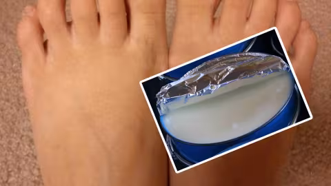 La vaseline pour éviter les ampoules