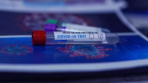 Coronavirus : un  dépistage rapide en masse tuera la pandémie en quelques semaines selon Harvard